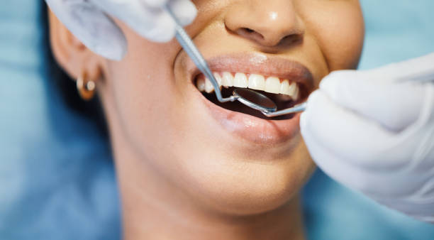 Best Dental Abscess Treatment in Cambridge, OH